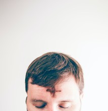 Photo of a man's forehead marked with ash in the shape of a cross
